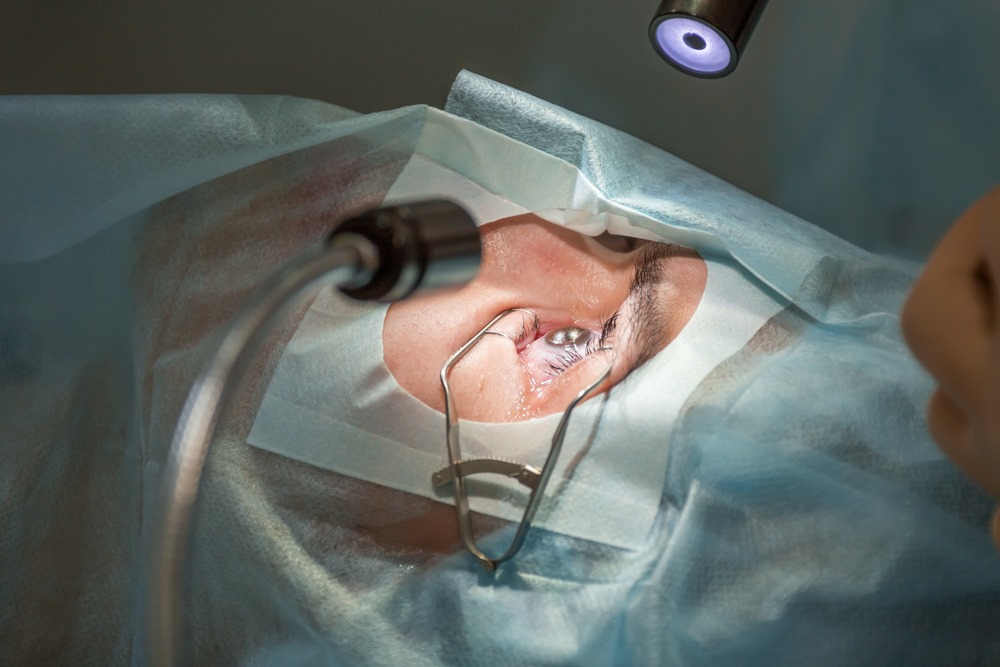 Understanding Packages and Discounts for Lasik Istanbul Cost